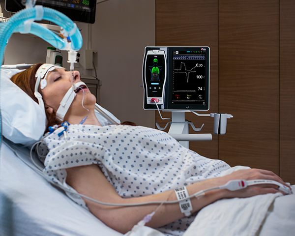 Intubated sleeping patient in hospital bed monitored by fingertip sensor with Root and Radical-7 bedside monitoring.