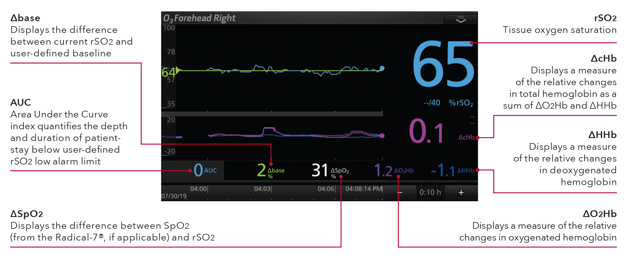 Masimo Root display showing available parameters.