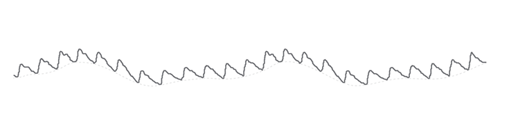 Image of plethysmographic waveform.