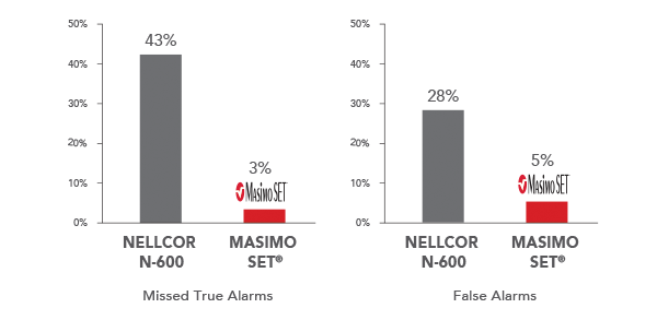 Masimo - Fiabilité des alarmes avec les performances de l’extraction du signal en cas mouvements et de perfusion faible